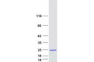 Western Blotting (WB) image for ADP-Ribosylation Factor 1 (ARF1) (Transcript Variant 1) protein (Myc-DYKDDDDK Tag) (ABIN2714424)