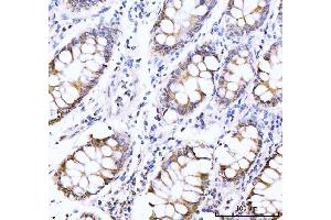 IHC analysis of AKAP 95/AKAP8 using anti-AKAP 95/AKAP8 antibody (ABIN7601553).