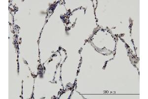 Immunoperoxidase of monoclonal antibody to ERH on formalin-fixed paraffin-embedded human lung. (ERH 抗体  (AA 1-104))