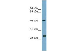 WB Suggested Anti-ART3 Antibody Titration:  0. (ART3 抗体  (Middle Region))