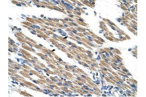 KEAP1 antibody was used for immunohistochemistry at a concentration of 4-8 ug/ml to stain Skeletal muscle cells (arrows) in Human Muscle. (KEAP1 抗体  (C-Term))