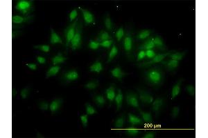 Immunofluorescence of monoclonal antibody to TUBG2 on HeLa cell. (TUBG2 抗体  (AA 1-100))