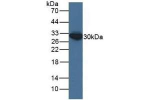 Detection of ECH1 in Human HepG2 Cells using Polyclonal Antibody to Enoyl Coenzyme A Hydratase 1, Peroxisomal (ECH1) (ECH1 抗体  (AA 1-328))