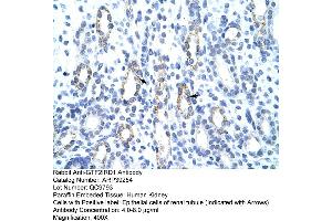 Immunohistochemistry (IHC) image for anti-General Transcription Factor II I Repeat Domain-Containing 1 (GTF2IRD1) (C-Term) antibody (ABIN2781010)