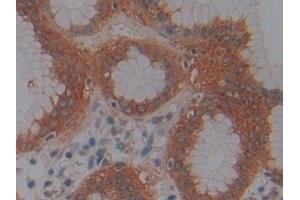Detection of KDM4A in Human Stomach Tissue using Polyclonal Antibody to Lysine Specific Demethylase 4A (KDM4A) (KDM4A 抗体  (AA 141-310))