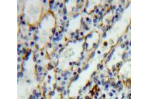 Used in DAB staining on fromalin fixed paraffin-embedded Spleen tissue (IL27 Receptor alpha 抗体  (AA 117-350))