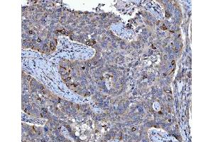 IHC analysis of CCNB1 using anti-CCNB1 antibody (ABIN7599335).