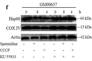Western Blotting (WB) image for anti-Cytochrome C Oxidase Subunit IV Isoform 1 (COX4I1) (Center) antibody (ABIN2855069)