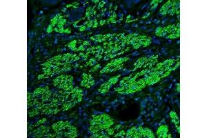 IF analysis of TAGLN/Transgelin using anti-TAGLN/Transgelin antibody (ABIN7600099). (Transgelin 抗体  (AA 15-170))