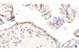 Immunohistochemistry (IHC) image for anti-Plasminogen Activator Inhibitor 1 (SERPINE1) antibody (ABIN7428149)