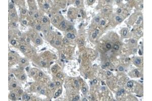 Immunohistochemistry (IHC) image for anti-Transforming Growth Factor, beta-Induced, 68kDa (TGFBI) (AA 423-632) antibody (ABIN7431149)