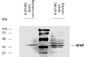 Detection of Glial fibrillary acidic protein (GFAP) by Western Blot. (GFAP 抗体)