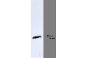 Image no. 1 for anti-Reticulon 1 (RTN1) antibody (ABIN959501) (Reticulon 1 抗体)
