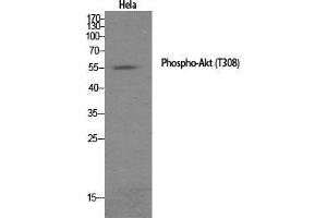 Western Blot (WB) analysis of specific cells using Phospho-Akt (T308) Polyclonal Antibody. (AKT1 抗体  (pThr308))