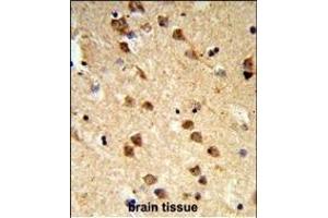 Immunohistochemistry (Paraffin-embedded Sections) (IHC (p)) image for anti-Ataxin 3 (ATXN3) (AA 261-288) antibody (ABIN653191)