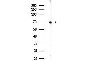 Western blot analysis of lysates from HUVEC cells(starvation,24h treatment), using Caldesmon Antibody at 1/1000 dilution.