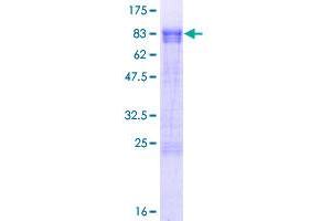 PPHLN1 Protein (AA 1-374) (GST tag)