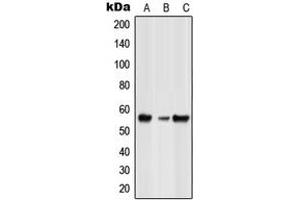 Western blot analysis of GLRB expression in HeLa (A), NIH3T3 (B), rat spleen (C) whole cell lysates. (GLRB 抗体  (Center))