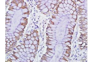 Immunohistochemistry (Paraffin-embedded Sections) (IHC (p)) image for anti-G Protein-Coupled Receptor 84 (GPR84) (AA 21-120) antibody (ABIN2173922)