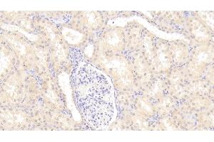 Detection of a2PI in Human Kidney Tissue using Polyclonal Antibody to Alpha 2-Antiplasmin (a2PI) (alpha 2 Antiplasmin 抗体)