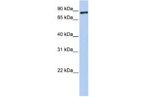 WB Suggested Anti-TMEM63A Antibody Titration:  0. (TMEM63A 抗体  (N-Term))