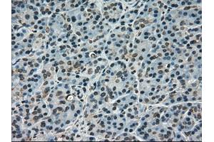 Immunohistochemical staining of paraffin-embedded pancreas tissue using anti-SCYL3mouse monoclonal antibody. (SCYL3 抗体)