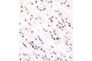 Immunohistochemistry (Paraffin-embedded Sections) (IHC (p)) image for anti-Parafibromin (CDC73) (AA 132-161) antibody (ABIN653128)