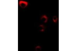 Immunofluorescent analysis of FDFT1 staining in MCF7 cells. (FDFT1 抗体)