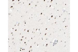 ABIN6266945 at 1/100 staining human brain tissue sections by IHC-P. (p300 抗体  (Internal Region))