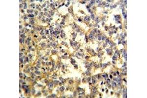 G6PD antibody IHC analysis in formalin fixed and paraffin embedded testis. (Glucose-6-Phosphate Dehydrogenase 抗体  (AA 297-326))
