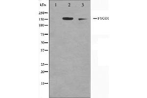 Western blot analysis on A549 and HuvEc cell lysate using FYCO1 Antibody,The lane on the left is treated with the antigen-specific peptide.
