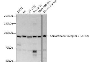 Western blot analysis of extracts of various cell lines, using Somatostatin Receptor 2 (SSTR2) antibody (ABIN3017442, ABIN3017443, ABIN3017444 and ABIN6220093) at 1:1000 dilution.