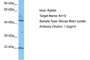 Host:  Mouse  Target Name:  KRT10  Sample Tissue:  Mouse Brain  Antibody Dilution:  1ug/ml (Keratin 10 抗体  (N-Term))