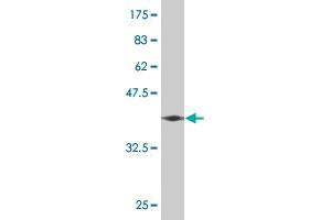 Western Blot detection against Immunogen (37. (GRIN2B 抗体  (AA 127-236))