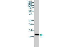 S100A9 monoclonal antibody (M01A), clone 1C10 Western Blot analysis of S100A9 expression in MCF-7 . (S100A9 抗体  (AA 1-114))