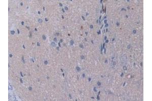 Immunohistochemistry (IHC) image for anti-Signal Transducing Adaptor Molecule (SH3 Domain and ITAM Motif) 1 (STAM) (AA 199-466) antibody (ABIN7443425)