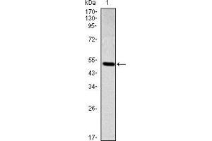 Western blot analysis using SMAD2 mAb against human SMAD2 (AA: 20-254) recombinant protein. (SMAD2 抗体)