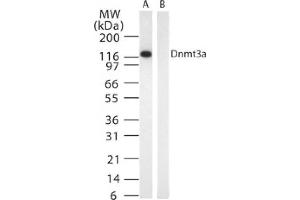 DNMT3A mAb tested by Western blot. (DNMT3A 抗体)