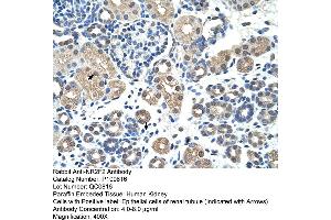 Immunohistochemistry (IHC) image for anti-Nuclear Receptor Subfamily 2, Group F, Member 2 (NR2F2) (N-Term) antibody (ABIN2792599)