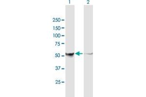 Western Blot analysis of PHGDH expression in transfected 293T cell line by PHGDH MaxPab polyclonal antibody. (PHGDH 抗体  (AA 1-533))