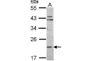 WB Image Sample (50 ug of whole cell lysate) A: mouse Liver 12% SDS PAGE antibody diluted at 1:1000 (RPL11 抗体)