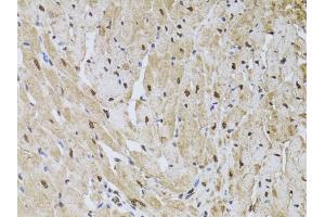 Immunohistochemistry (IHC) image for anti-HUS1 Checkpoint Homolog (S. Pombe) (HUS1) (AA 1-280) antibody (ABIN6142084)