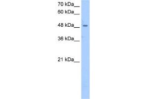 WB Suggested Anti-SSB Antibody Titration:  2. (SSB 抗体  (Middle Region))