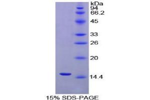 SDS-PAGE analysis of Chicken Inhibin beta A Protein. (INHBA 蛋白)