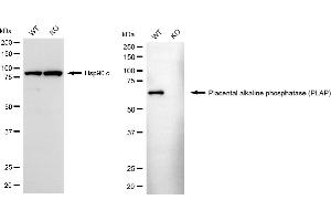 anti-Placental Alkaline Phosphatase (ALPP) antibody
