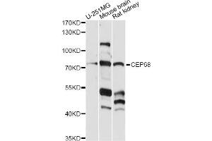 Western blot analysis of extracts of various cell lines, using CEP68 antibody (ABIN6292482) at 1:1000 dilution.