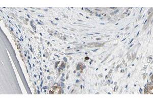 ABIN6279421 at 1/100 staining Human prostate tissue by IHC-P. (EIF3S1 抗体  (Internal Region))
