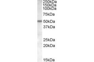 ABIN302140 (1µg/ml) staining of Human Cerebellum lysate (35µg protein in RIPA buffer). (CHRNB3 抗体  (Internal Region))