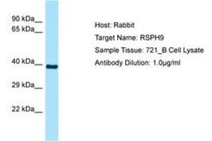 Image no. 1 for anti-Radial Spoke Head 9 Homolog (RSPH9) (AA 52-101) antibody (ABIN6749895) (RSPH9 抗体  (AA 52-101))