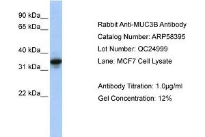 WB Suggested Anti-MUC3B  Antibody Titration: 0. (MUC3B 抗体  (N-Term))